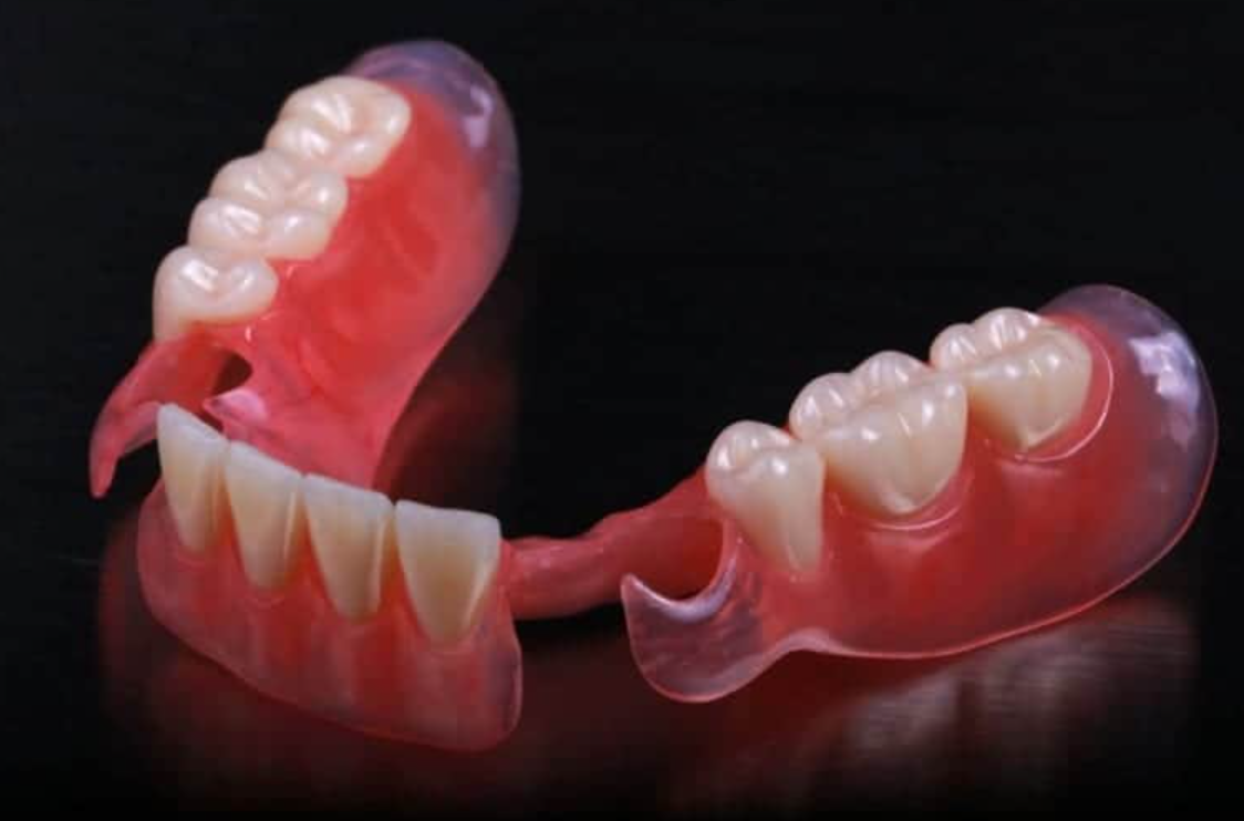 Valplast partial denture Bilateral